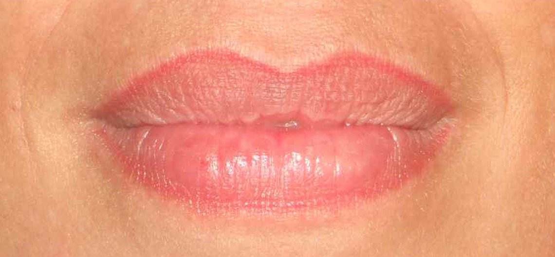 Lipcontour permanente make-up