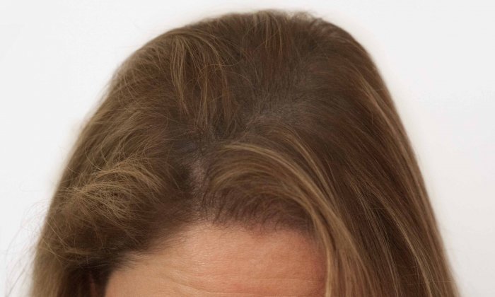 Haar pigmentatie vrouw